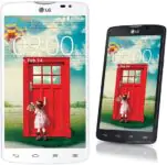 LG L80 Dual reparation-lg-l80-dual1