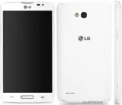 LG L80 reparation-lg-l80-single-sim